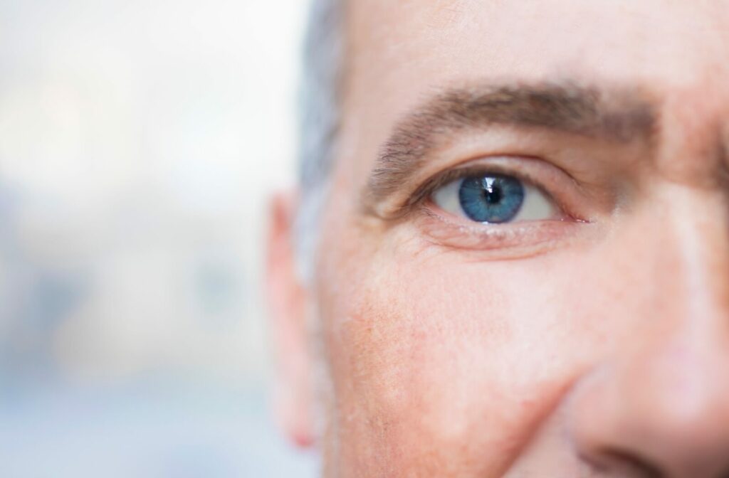 Someone's eyes are clear and healthy, free of the irritation of dry eyes.