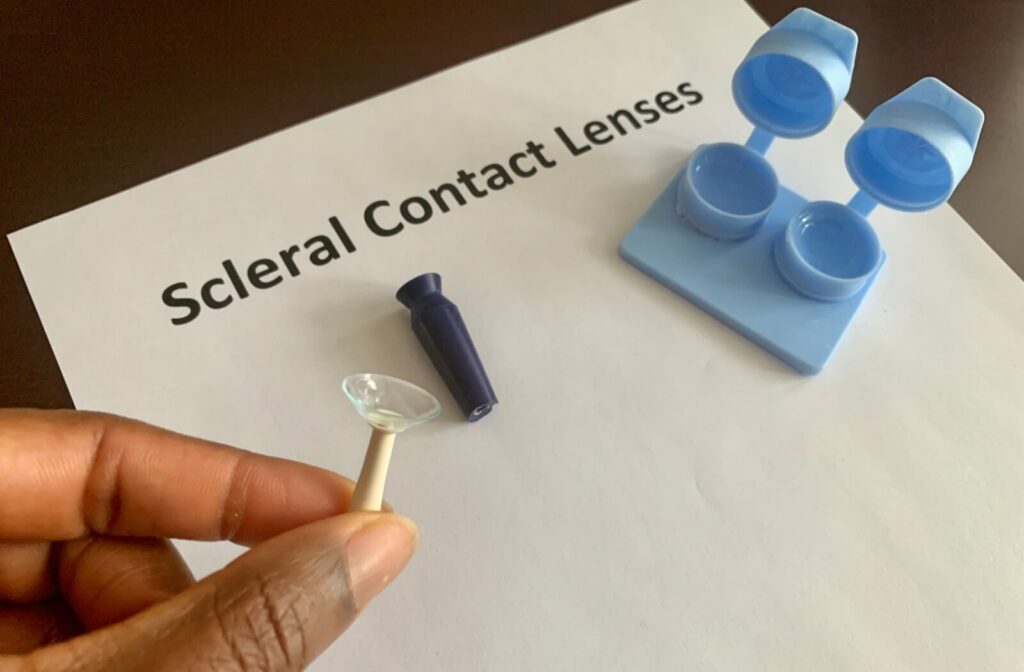 A scleral contact lens is being held by the applicator tool.