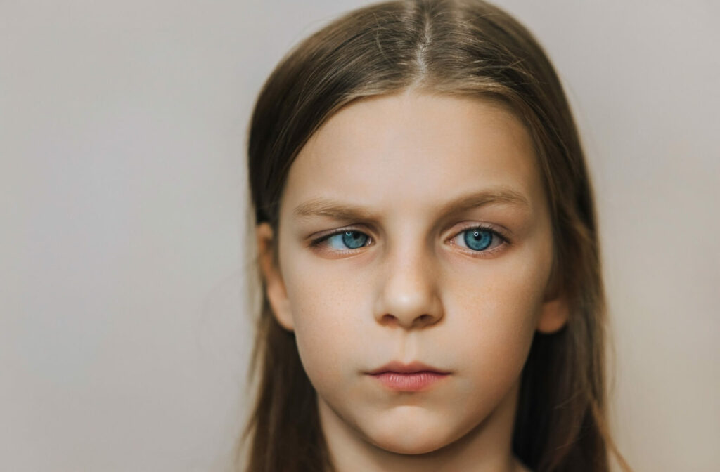 A young girl with visible eye misalignment, illustrating common symptoms of strabismus or "crossed eyes" in children and adults.